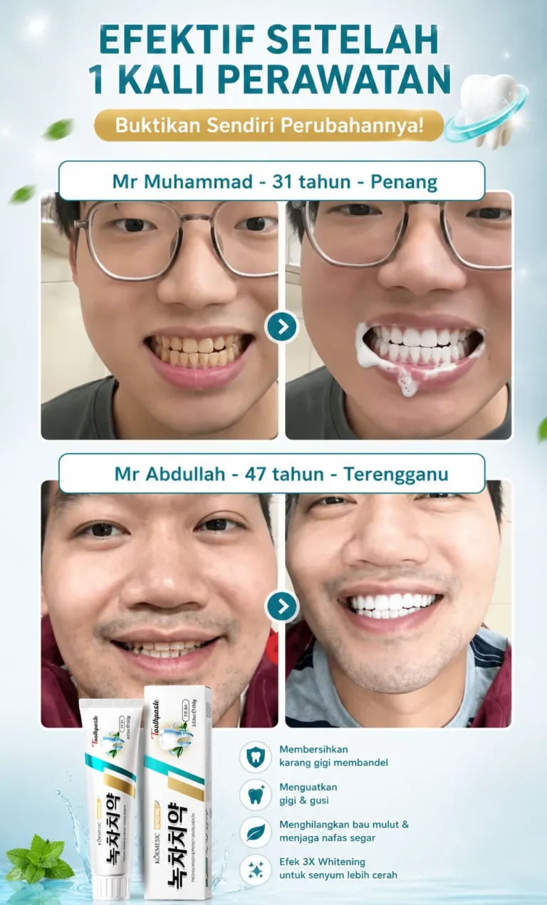 Masalah Gigi Kuning